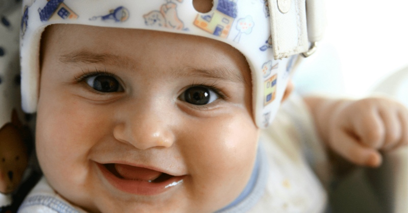 Assimetria craniana: o capacete para bebé resolve?