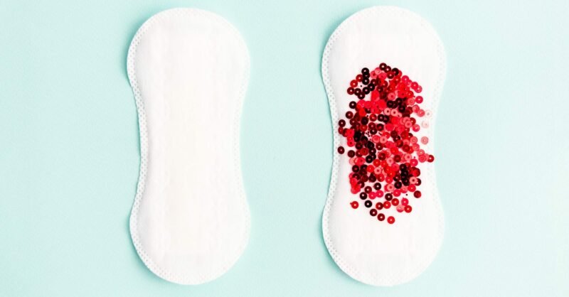 Menstruação atrasada: será uma gravidez ou haverá outro motivo?